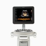 Philips-ClearVue-550-Ultrasound-350x350